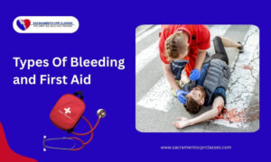 types of bleeding: symptoms of different types of bleeding and how to give first aid to different types of bleeding